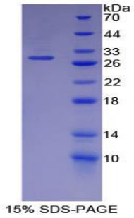 SDS-PAGE